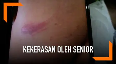 Seorang siswa madrasah di Ogan Ilir, Sumatera Selatan mengaku dianiaya oleh senior saat kegiatan pramuka. Tak terima, orangtua melaporkan kejadian ini ke polisi.