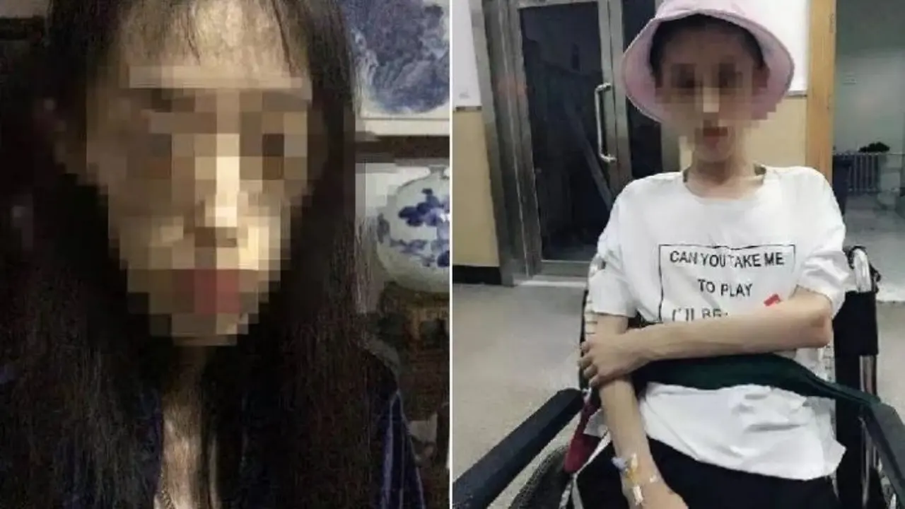 [Bintang] Dibilang Gendut Perempuan Ini Jalani Diet Ekstrem, Kini Beratnya Hanya 25 Kg