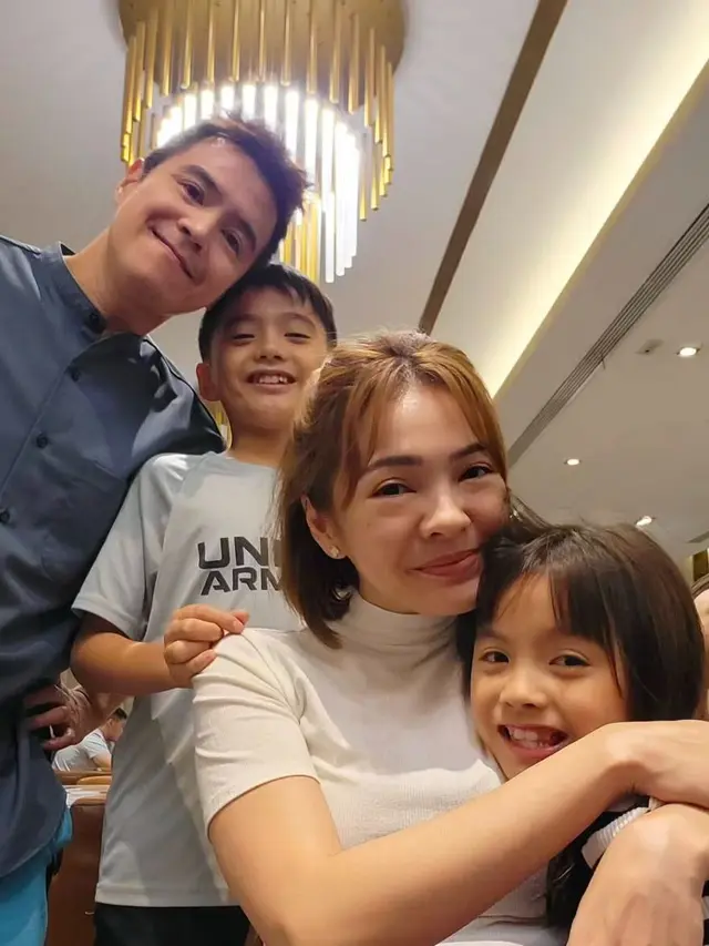 Maya Septha Operasi Plastik Hidung dan Kantong Mata (Instagram/@mayaseptha7)