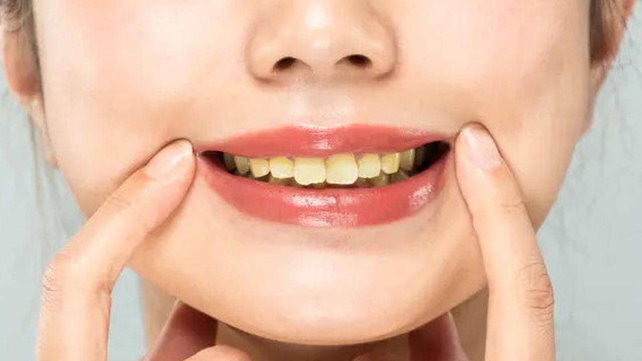 Tips Memutihkan Gigi Kuning Menggunakan Garam dan Satu Bahan Tambahan Ini