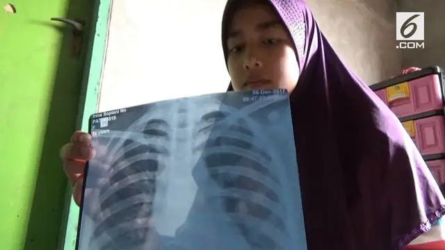 Seorang siswi di Sumedang tidak sengaja menelang jarum pentul.