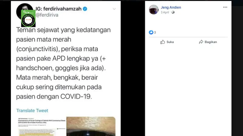 Mata Merah, Bengkak dan Berair Gejala Posif COVID-19? Simak Faktanya