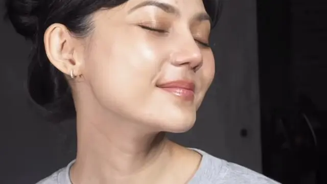 Rina Nose Setelah Enam Minggu Menjalani Operasi Plastik pada hidung dan kantung mata. [@dr_tompi]