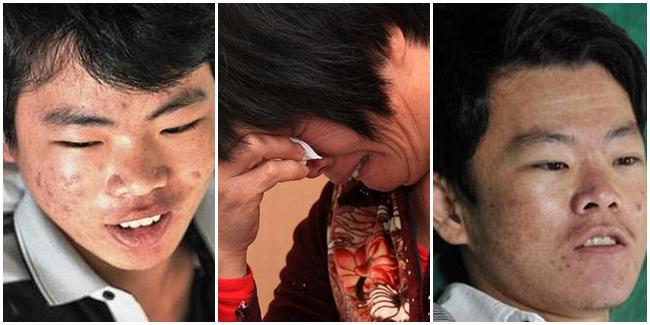 Ibu harus memilih kepada siapa ginjalnya didonorkan, pada putra sulungnya Haiqing (kiri) atau si bungsu Haisong (kanan). | Foto: copyright dailymail.co.uk