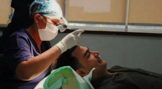 Peringatan Ahli soal Risiko Transplantasi Rambut