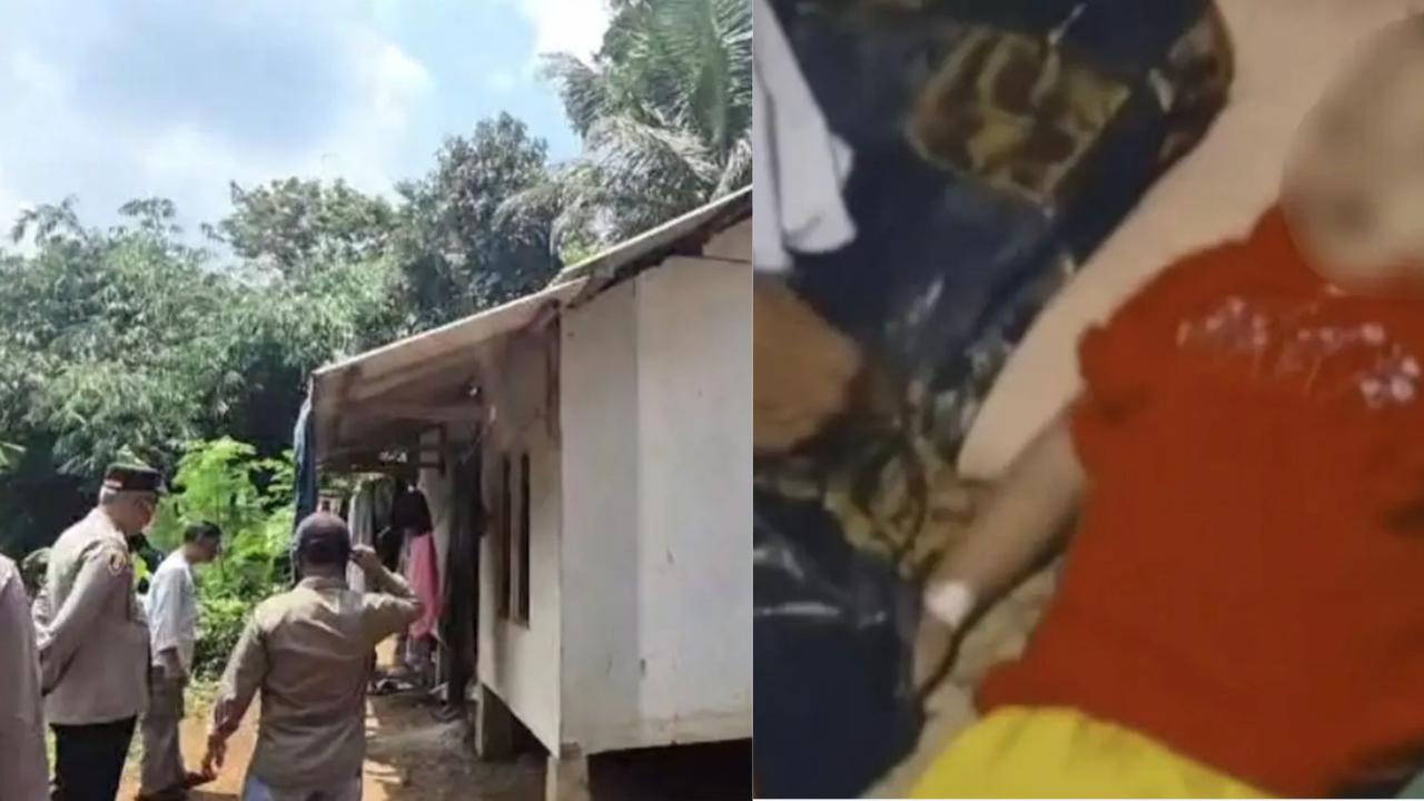 Kisah Raya, Bocah 3 Tahun Ortu ODGJ Meninggal Akibat Tubuh dan Otaknya Dipenuhi Cacing Gelang