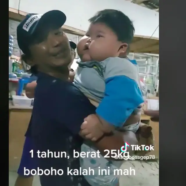 Viral bayi 1 tahun miliki berat badan 25 kg