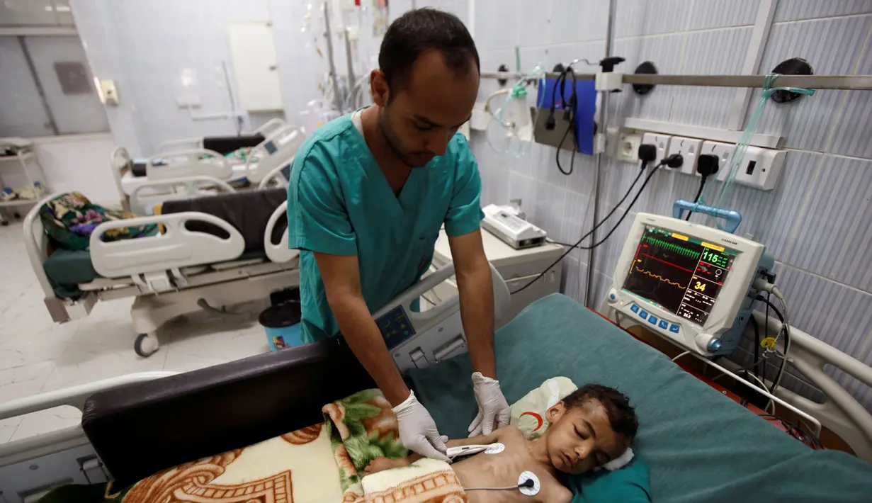 Perawat memeriksa seorang bocah di sebuah unit perawatan intensif sebuah RS di Sanaa, Yaman pada 27 September 2016. PBB mencatat lebih dari setengah penduduk Yaman tidak memiliki cukup makanan. (REUTERS/Khaled Abdullah)