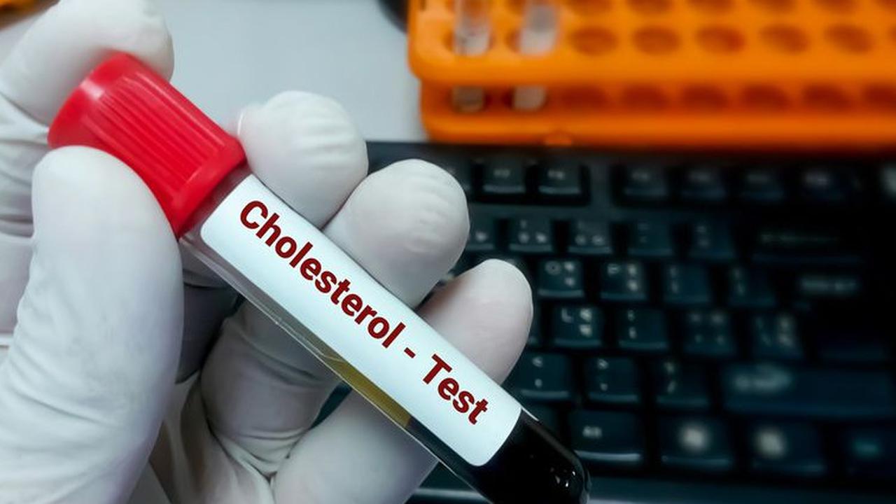 Bahaya Kolesterol Tinggi di Usia Muda, Ancaman Serius yang Sering Diabaikan