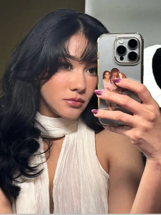 Naysilla Mirdad Jalani Mini-Facelift dan Fat Graft. [@naymirdad]