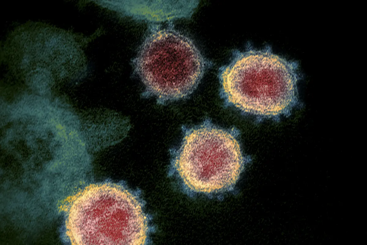 Gambar ilustrasi ini dengan izin dari National Institutes of Health pada 27 Februari 2020. Menunjukkan mikroskopis elektron transmisi SARS-CoV-2 juga dikenal sebagai 2019-nCoV, virus yang menyebabkan Corona COVID-19. (AFP/National Institutes of Health).