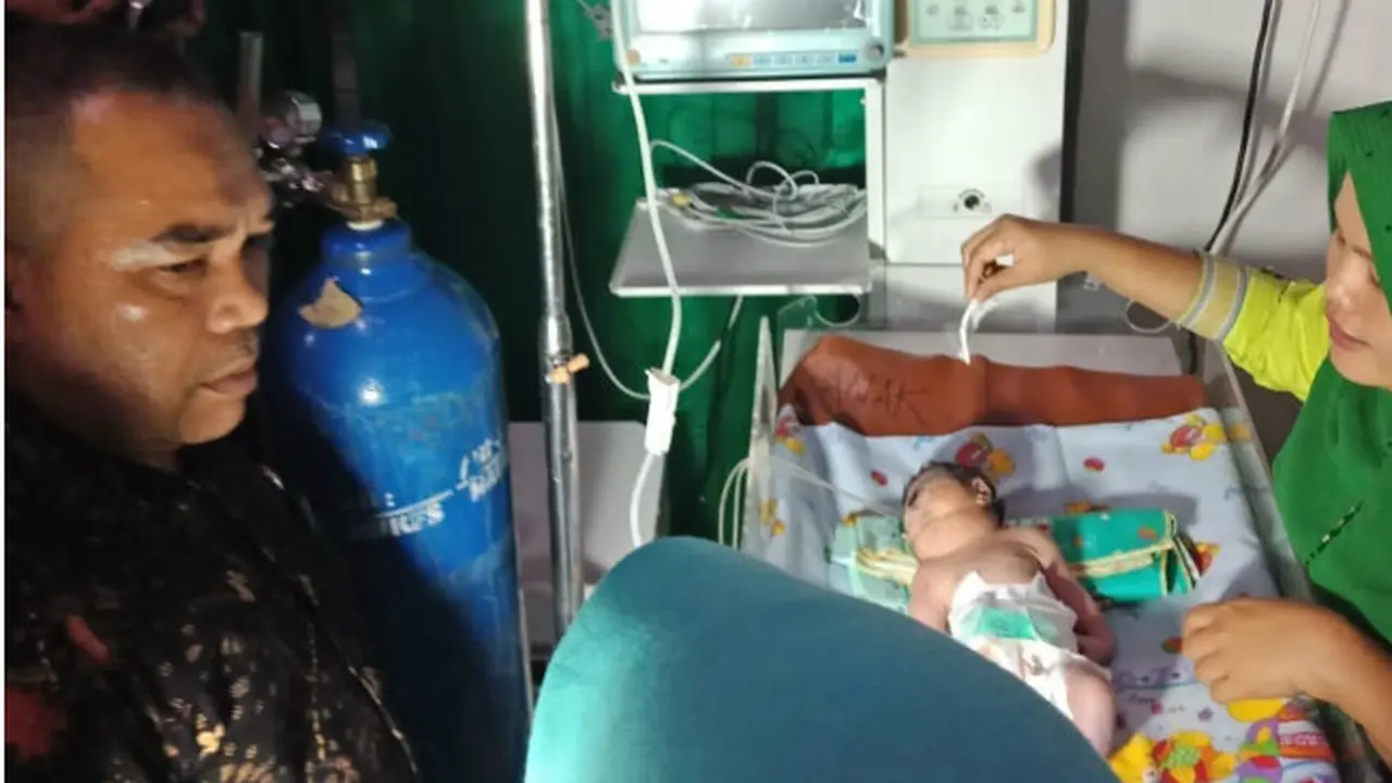 Bayi Bermata Satu dari Mandailing Natal