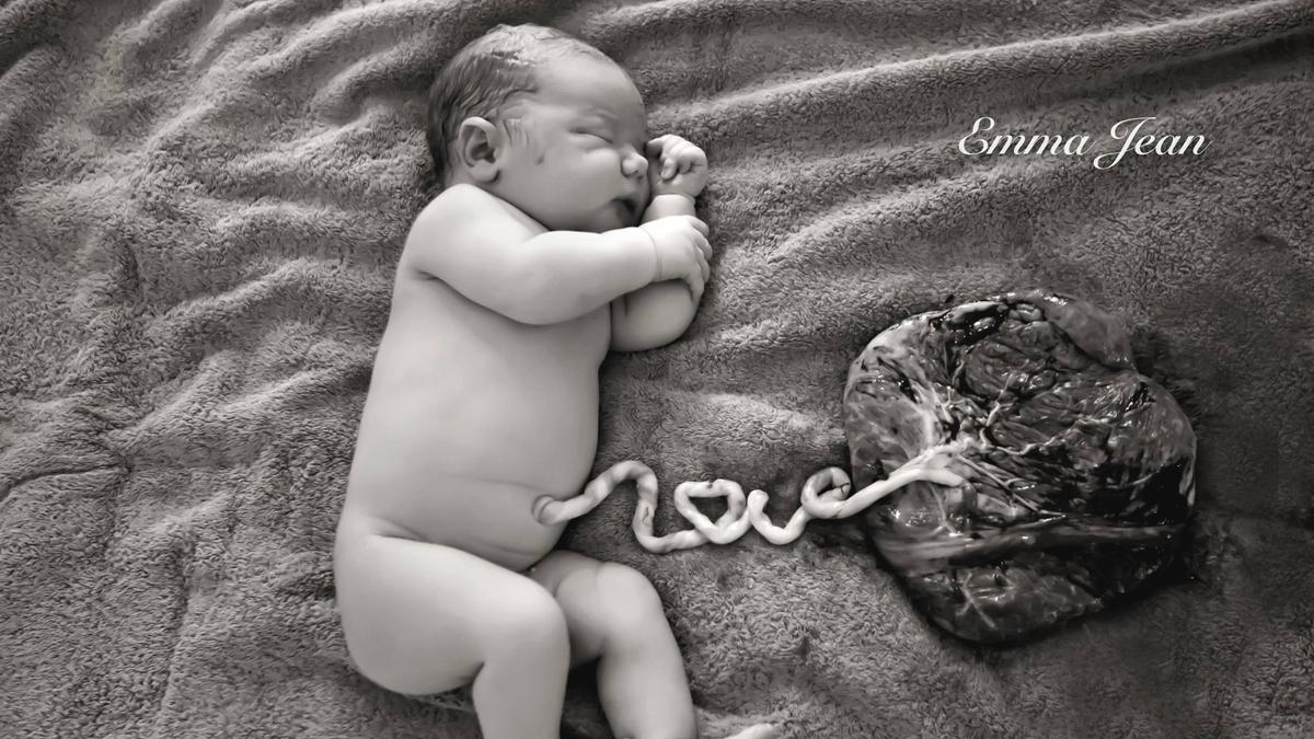 Bidan Ini Abadikan Bayi dan Plasentanya Lewat Foto Menyentuh Hati -  Lifestyle Fimela.com