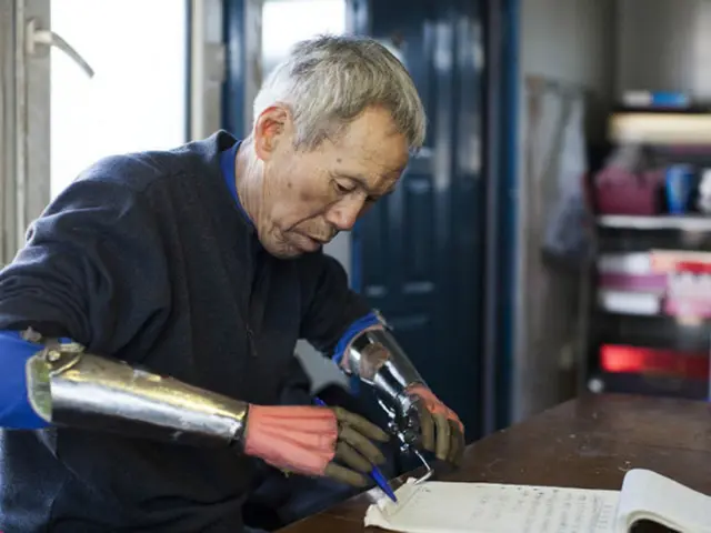 Kaki Dan Tangan Palsu Buatan Si Tangan Besi Lifestyle Fimela Com