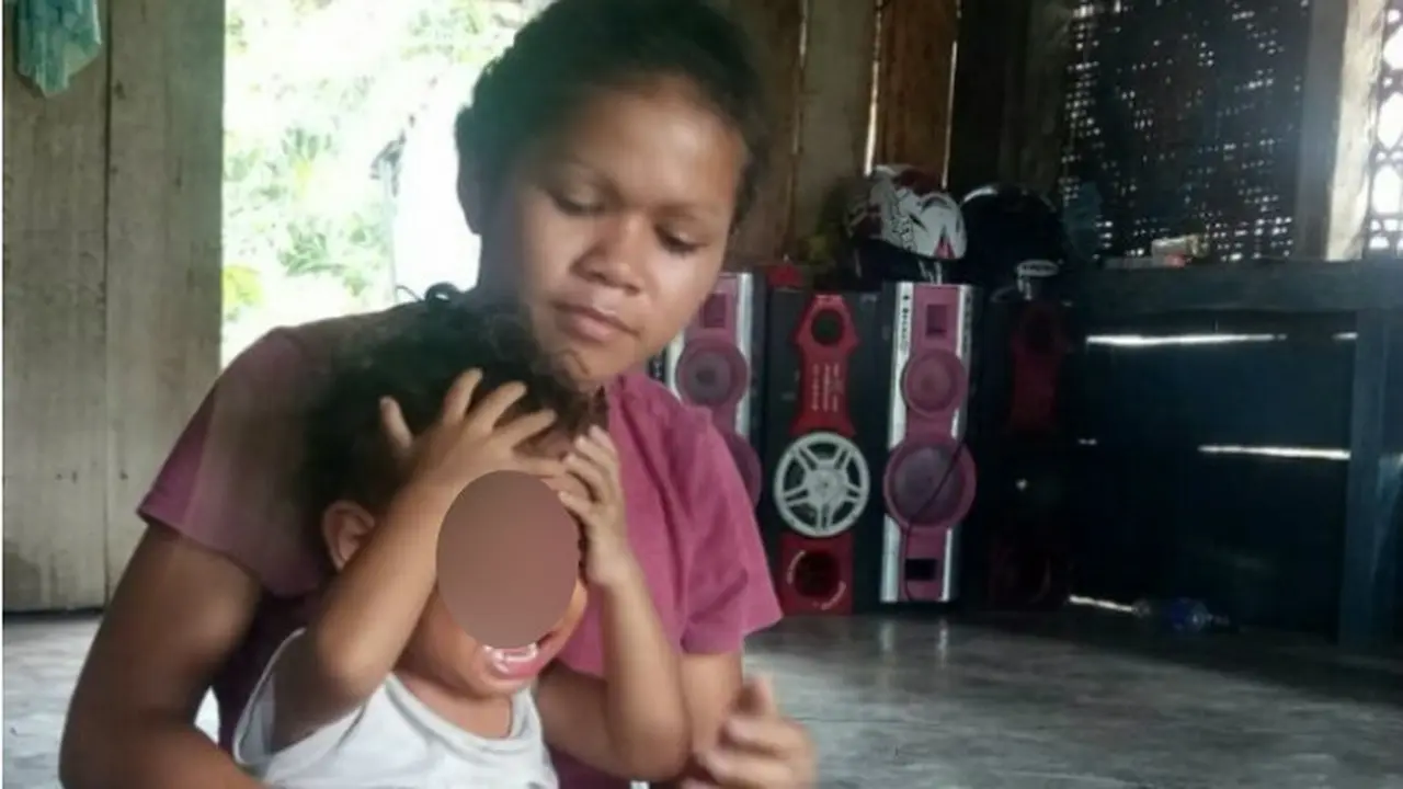 Derita Rifky, Bocah 2 Tahun Menderita Tumor Mata