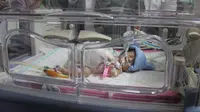 Aysha, salah satu bayi kembar siam yang berhasil selamat usai operasi pemisahan selama 7 jam di RSMH Palembang (Dok. Humas Pemprov Sumsel / Nefri Inge)