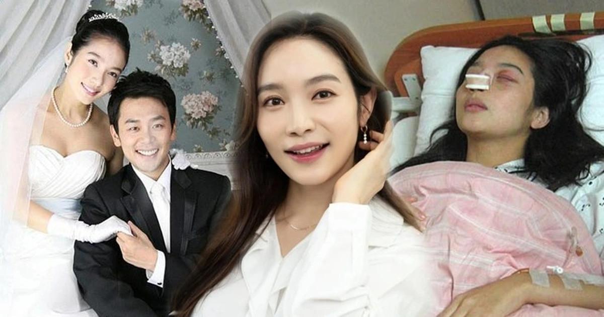 Lee Min-young dan Lee Chan