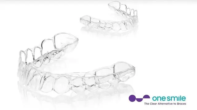 clear aligners