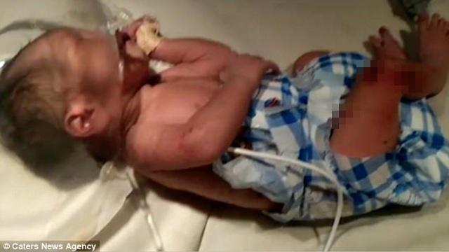 Beruntung, bayi malang bisa diselamatkan dan mendapatkan perawatan intensif di rumah sakit setempat/copyright viral4real.com