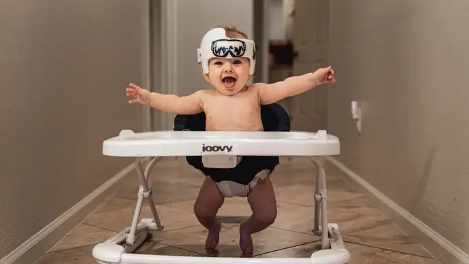 Berbahaya bagi Bayi, Ini 3 Alasan Utama Mengapa Penggunaan Baby Walker Tidak Dianjurkan