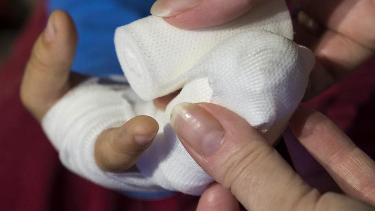 6 Cara Menangani Luka pada Anak Menurut Dokter Spesialis Anak Mesty Ariotedjo