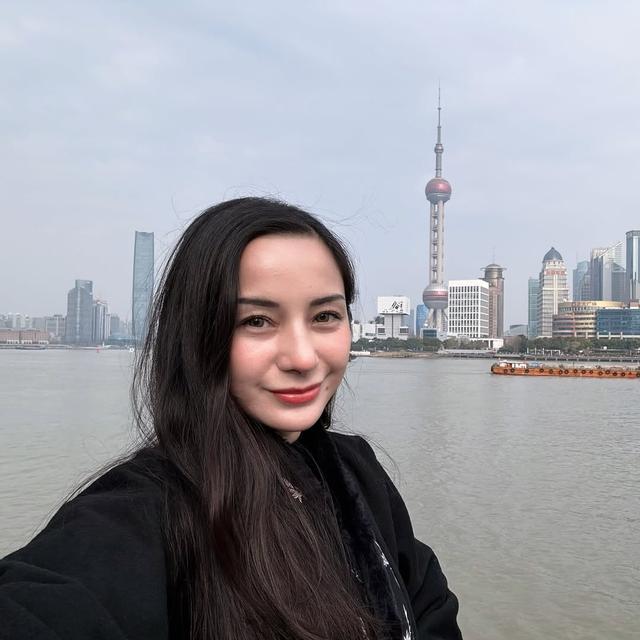 6 Potret Terbaru Kirana Larasati Usai Rhinoplasty, Akui untuk Estetika