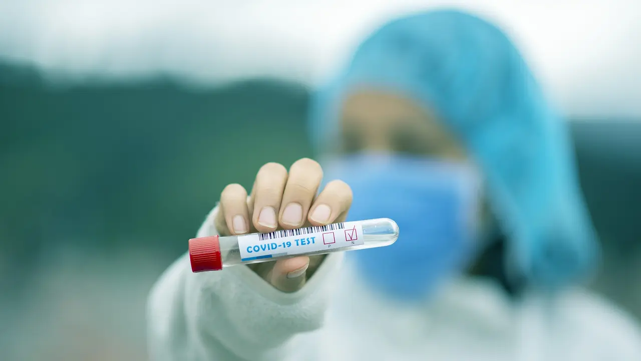 Tes Virus Corona Covid-19