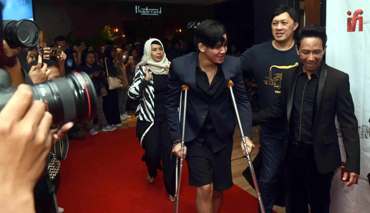 "Ada marmer yang somplak. Jadi pas lompat dia langsung sobek, banyak darahnya. Keluarga panik. Waktu lagi berenang semua temen-temen cowo yang bareng berenang juga pada panik," jelasnya. (Nurwahyunan/Bintang.com)