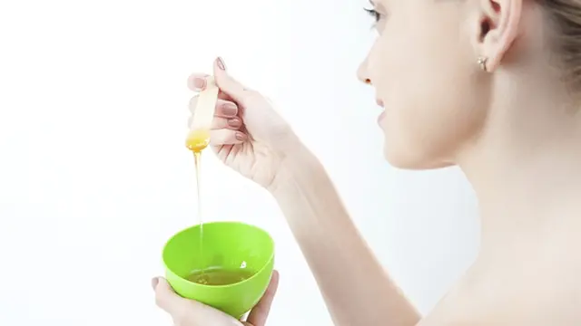 Foto: copyright Vemale.com