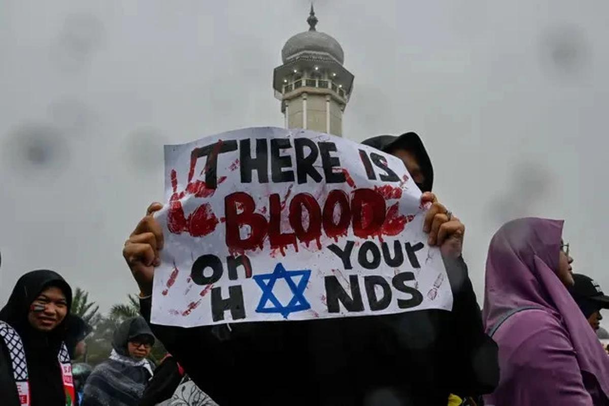 Startup Pakistan Kirim Kaki Prostetik untuk Anak Gaza Korban Serangan Israel