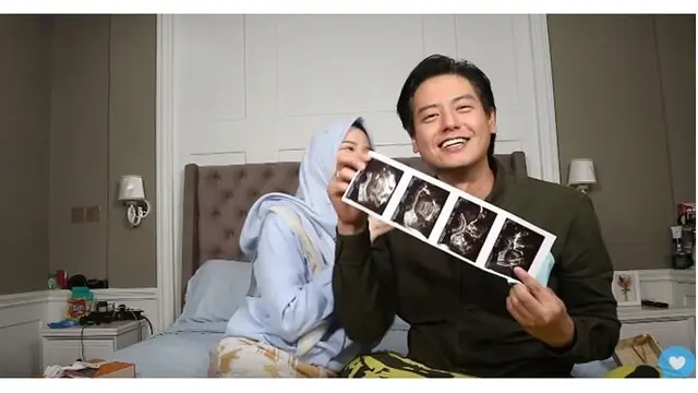 Keduanya kompak mengumukan kehamilan anak pertama, Roger juga menunjukkan hasil foto USG.