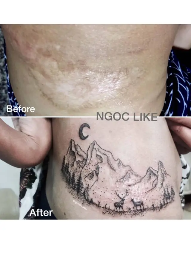 7 Potret Tato Keren Sulap Bekas Luka Jadi Seni Indah