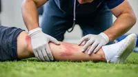 Dokter Sebut Cedera Olahraga Tak Selalu karena Kurang Pemanasan