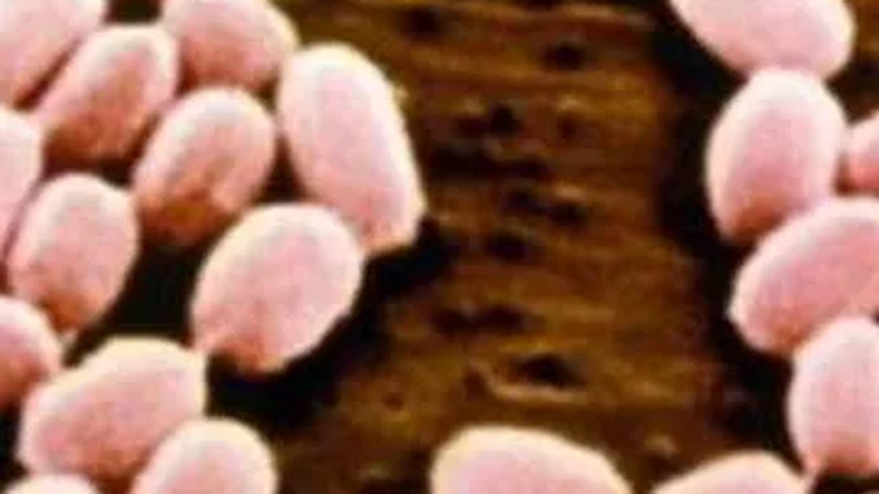 Spora inilah yang berpotensi menyebabkan penularan. Bisa melalui makanan maupun minuman hewan ternak. Termasuk penularan lewat udara terhirup oleh hewan ternak ataupun manusia.