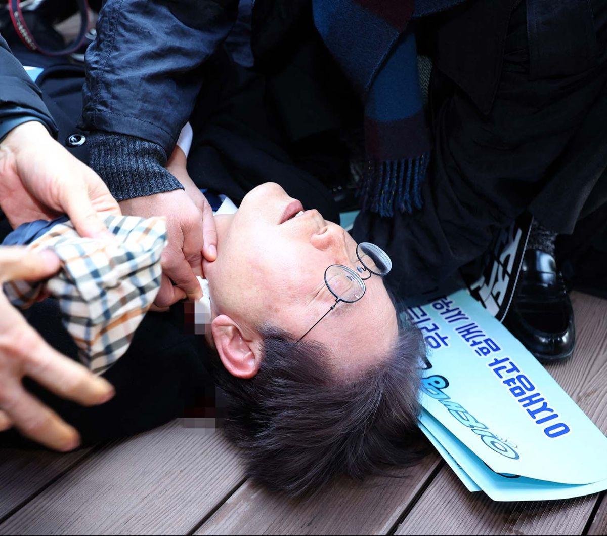 Pemimpin partai oposisi Korea Selatan, Lee Jae-myung menjadi korban penyerangan oleh orang tak dikenal. Dia ditikam di lehernya ketika memberikan keterangan pers dalam kunjungannya di Busan, Korea Selatan, Selasa (2/1/2024).&nbsp;