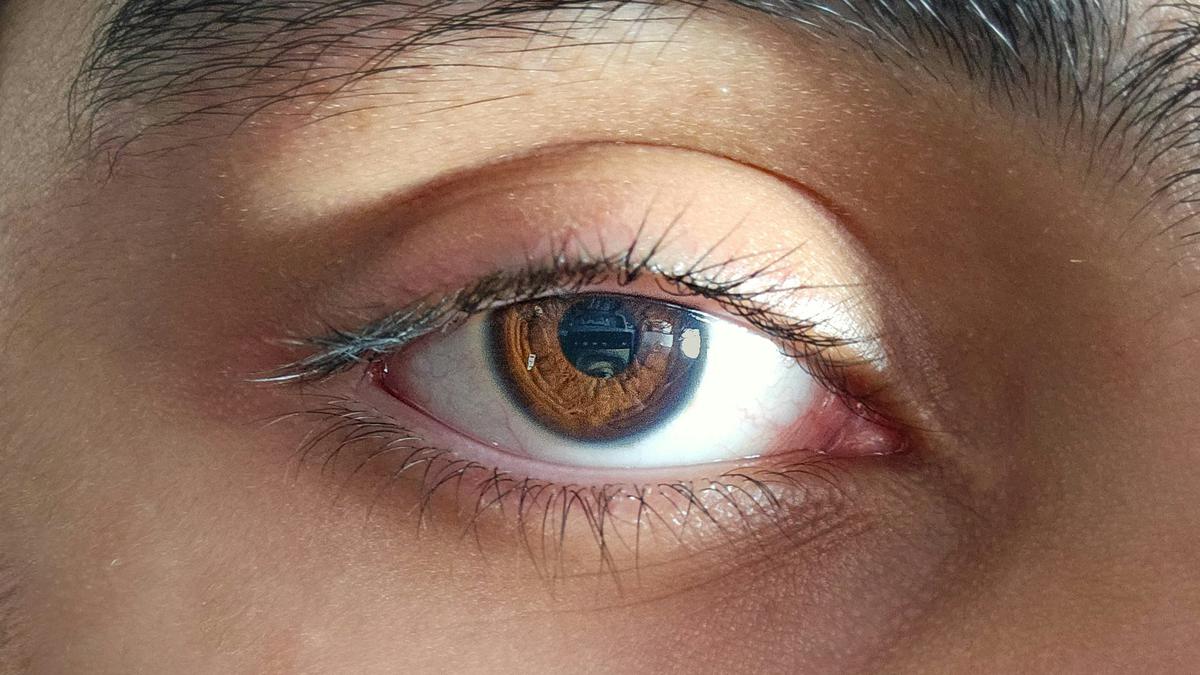 Melihat seperti Ada Benang Melayang di Mata? Kenali Floaters dan Penyebabnya