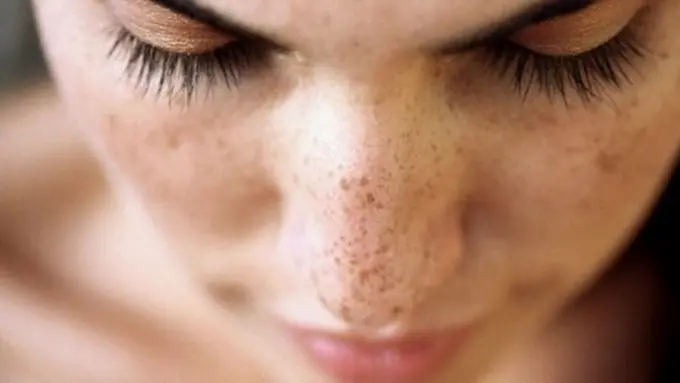 3 Bahan Ini Ampuh Hilangkan Flek Hitam di Wajah