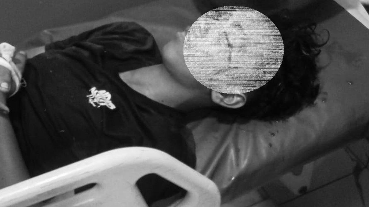 Siswa SMA di Medan Labuhan Tewas Tertembak Tembus ke Mata, Ibu Korban Lapor Polisi