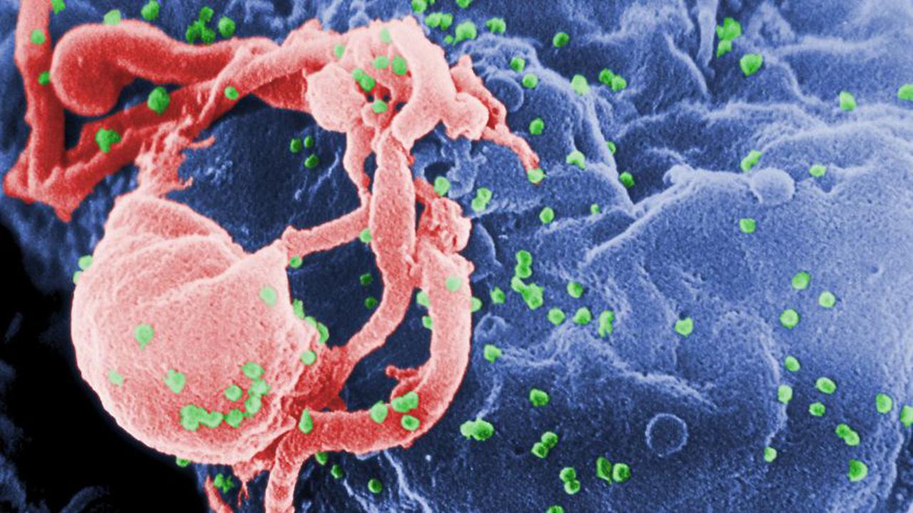 10 Anak Terinfeksi HIV Usai Transfusi Darah