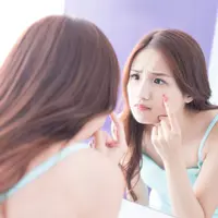 Ilustrasi jerawat/copyright shutterstock