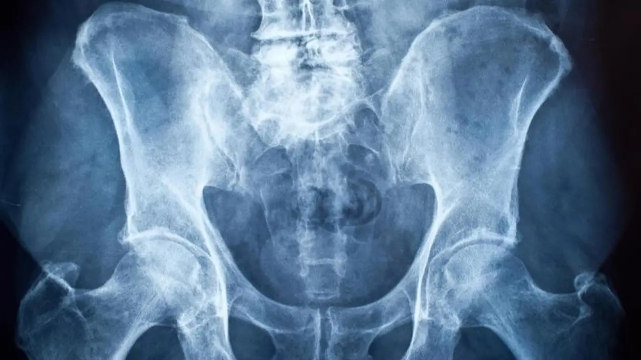 Hubungan Seks yang Pendek, Alasan Manusia Tak Punya Tulang Penis