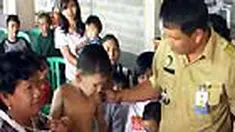 Di tengah musim pancaroba, penyakit kulit herpes menjangkiti warga Surabaya, Jatim. Hal tersebut terlihat di daerah Wonorejo yang banyak warganya menderita herpes.