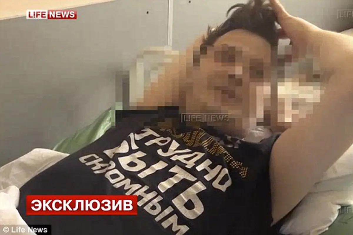 Sadar dari Obat Bius, Aktor Rusia Kehilangan Testisnya