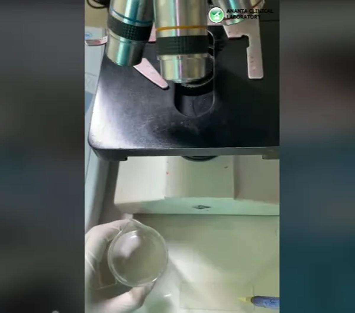 Dalam video dijelaskan Ia mengambil sample 1 tetes sel sperma.  <br>
