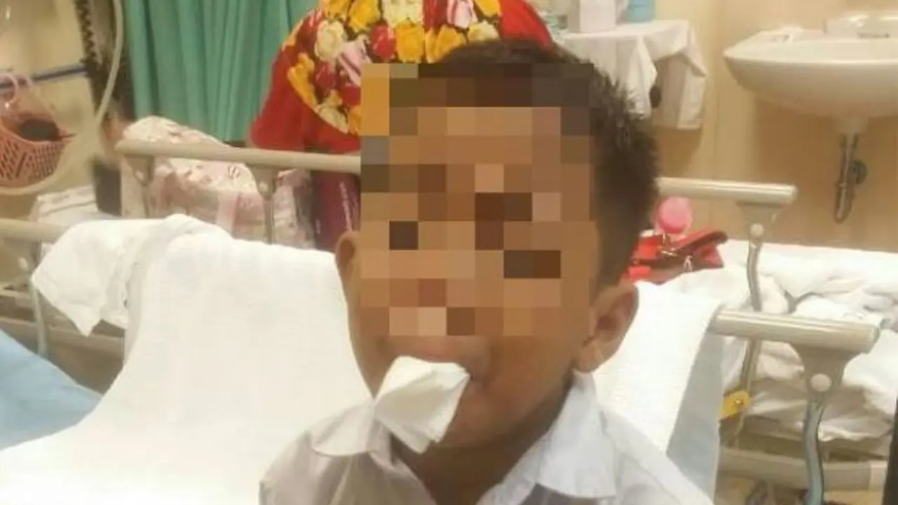 Takut Ditinju Lagi, Bocah Ini Nekat Potong Lidah