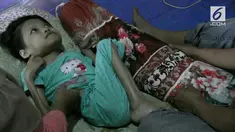 Seorang bocah mengalami kelumpuhan akibat menderita virus CMV, hingga kini hidup dalam kondisi memprihatinkan.