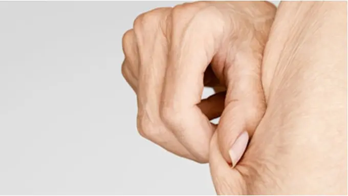 Foto: copyright img.webmd.com