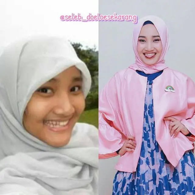 7 Transformasi Fatin Shidqia Lubis, Dari Anak Sekolah Hingga Selebriti