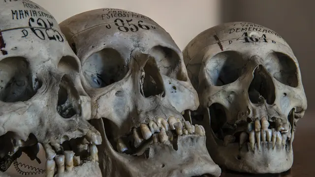 skull (unsplash.com/v2osk)