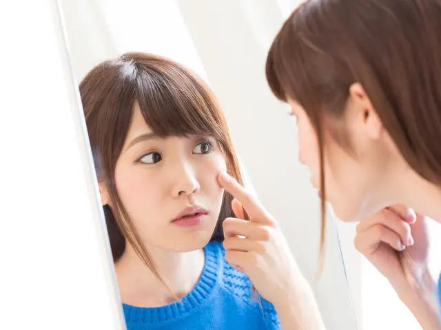 10 Produk Skincare Terbaik Efektif Atasi Komedo Membandel Beauty Fimela Com
